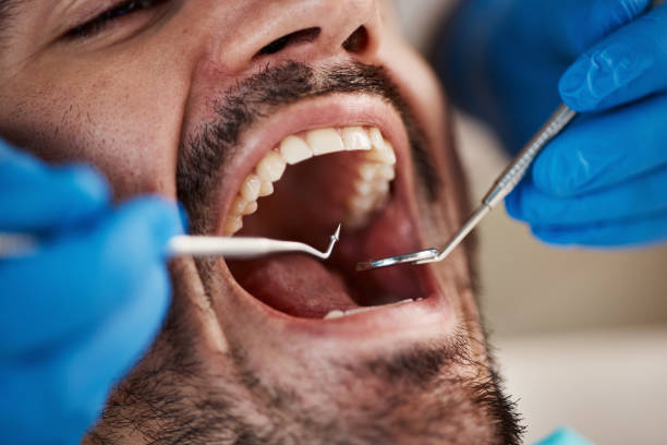 Best Emergency TMJ Treatment in Hermitage, PA