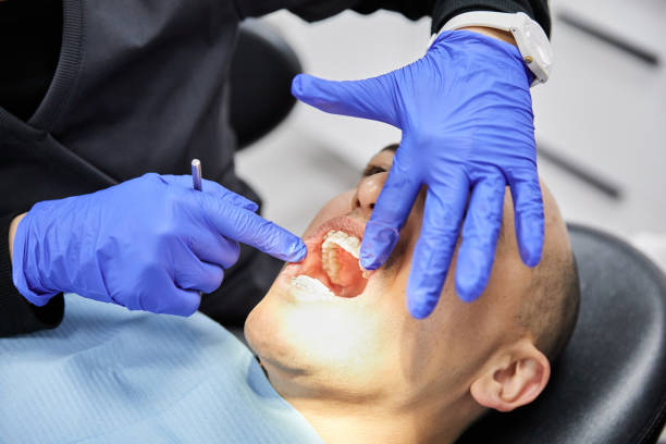 Best Emergency Treatment for Dental Infections or Abscesses in Hermitage, PA